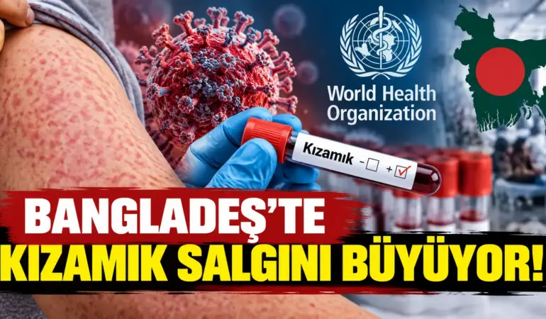 angladeş’te Kızamık Salgını Büyüyor: Hayatını Kaybeden Çocuk Sayısı 1.201’e Yükseldi!