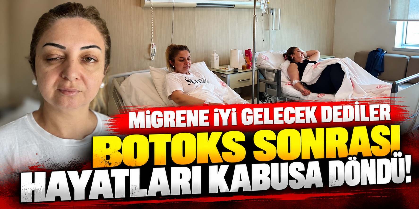 Migren İçin Botoks Yaptırdılar, Hastanelik Oldular! 3 Kadının Korku Dolu Günleri