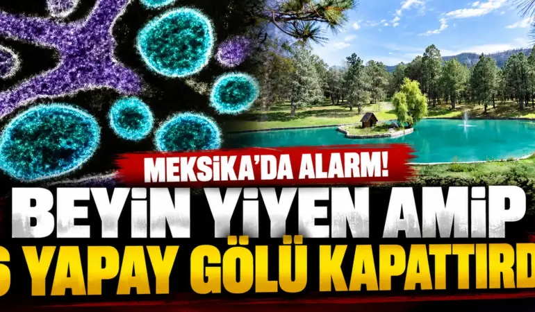 Meksika’da Beyin Yiyen Amip Alarmı! Bir Kişi Öldü, 6 Yapay Göl Kapatıldı