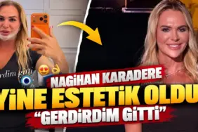 Nagihan Karadere’nin Estetik Dönüşümü