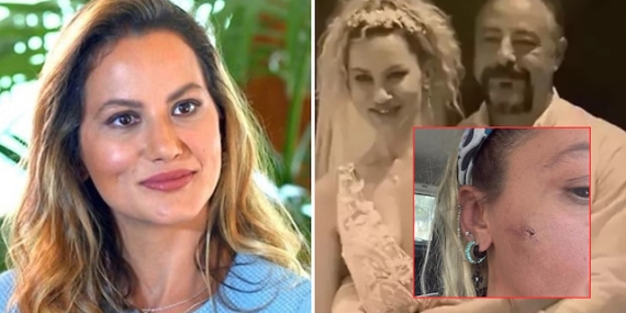 Ünlü Oyuncu Yıldız Asyalı, Eşinden Şiddet Gördüğünü Açıkladı