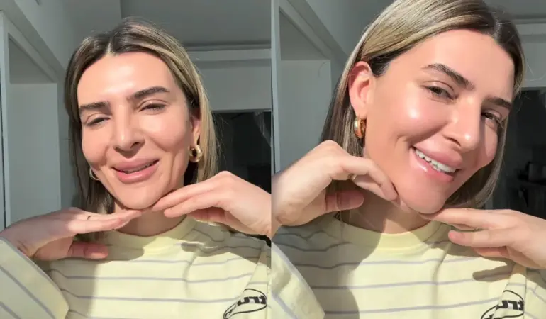 Survivor yıldızı Merve Aydın’ın lazer sonrası görüntüsü olay oldu