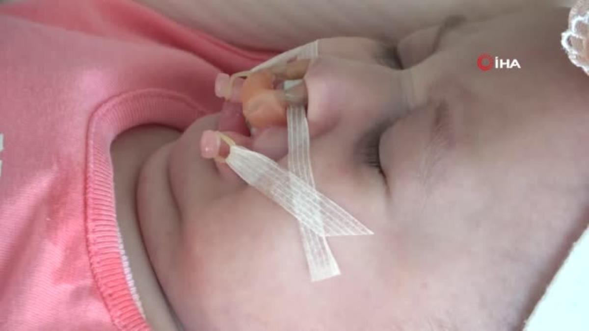 Çift taraflı dudak-damak yarığı ile doğan bebek sağlığına kavuşacak