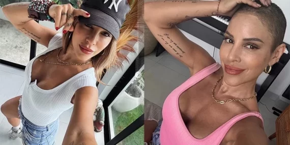 Kanserle Mücadele Eden Irmak Ünal’dan Yürek Burkan Açıklamalar