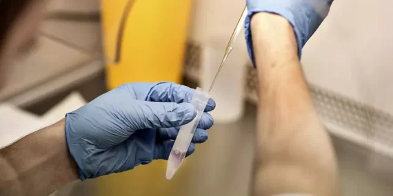 Sperm Bağışında Felaket: Avrupa’da Çocuklar Ölümcül Mutasyonla Dünyaya Geldi