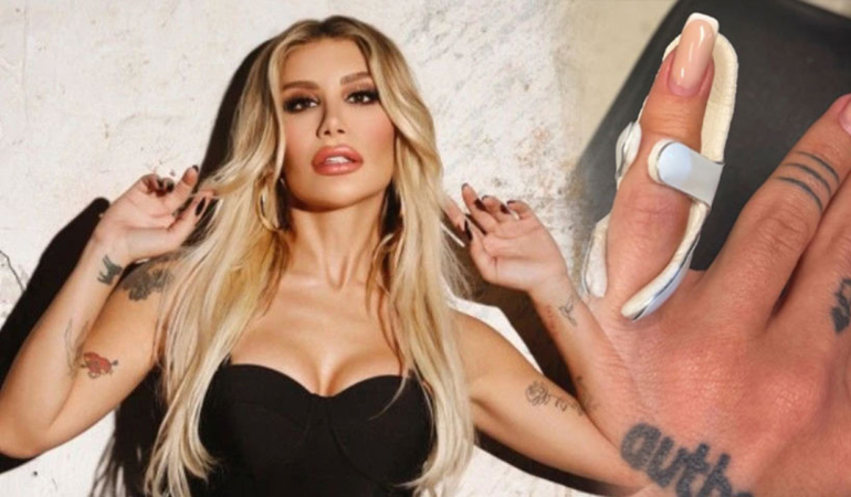 İrem Derici’yi Hastanelik Eden Ağrı! Sebebi Duyanları Şoke Etti